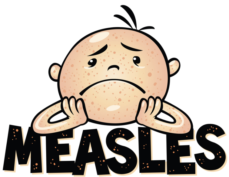 A Comeback for Measles?