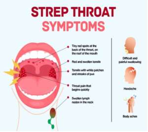 Strep Throat: Key Facts - West Plano Pediatrics